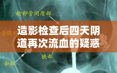 造影檢查后陰道出血，原因解析與醫(yī)學指導