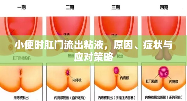 肛門粘液流出，原因、癥狀分析及應(yīng)對(duì)措施