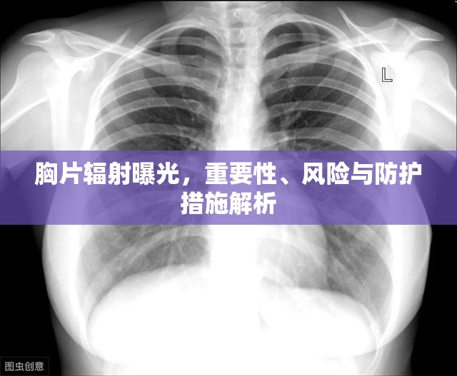 胸片輻射曝光，重要性、風險評估與防護策略