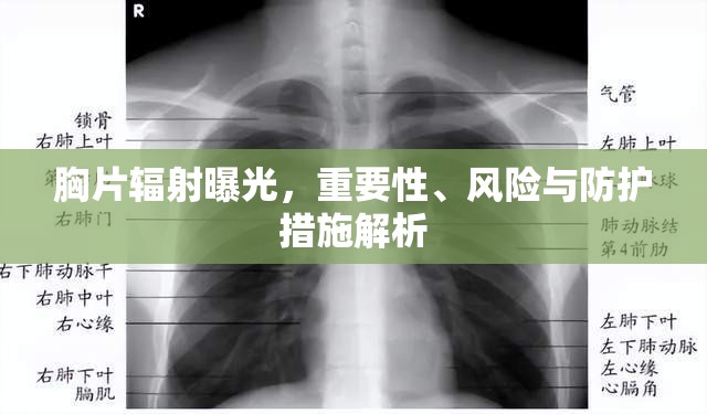胸片輻射曝光，重要性、風險評估與防護策略