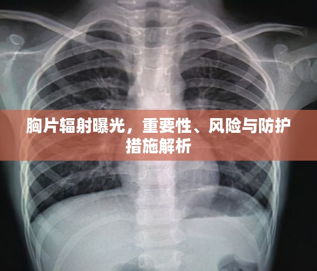 胸片輻射曝光，重要性、風險評估與防護策略