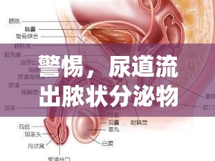 警惕，尿道流出膿狀分泌物，泌尿系統(tǒng)健康警報(bào)