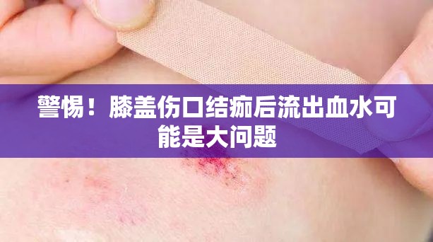 警惕！膝蓋傷口結(jié)痂后流出血水可能是大問(wèn)題
