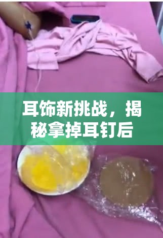 耳飾新挑戰(zhàn)，揭秘拿掉耳釘后為何會有血塊流出