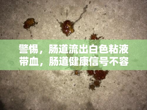 腸道異常，白色粘液帶血的警示信號