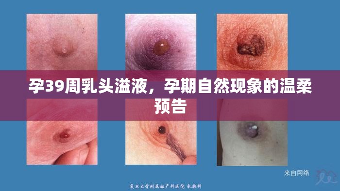 孕晚期乳頭溢液，孕期自然變化的溫馨信號(hào)