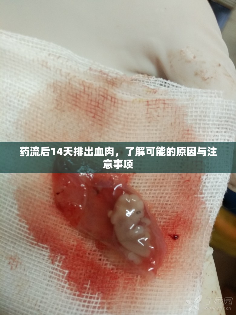 藥流后14天排出血肉，了解可能的原因與注意事項