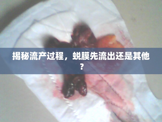 流產過程解析，蛻膜流出順序及其影響