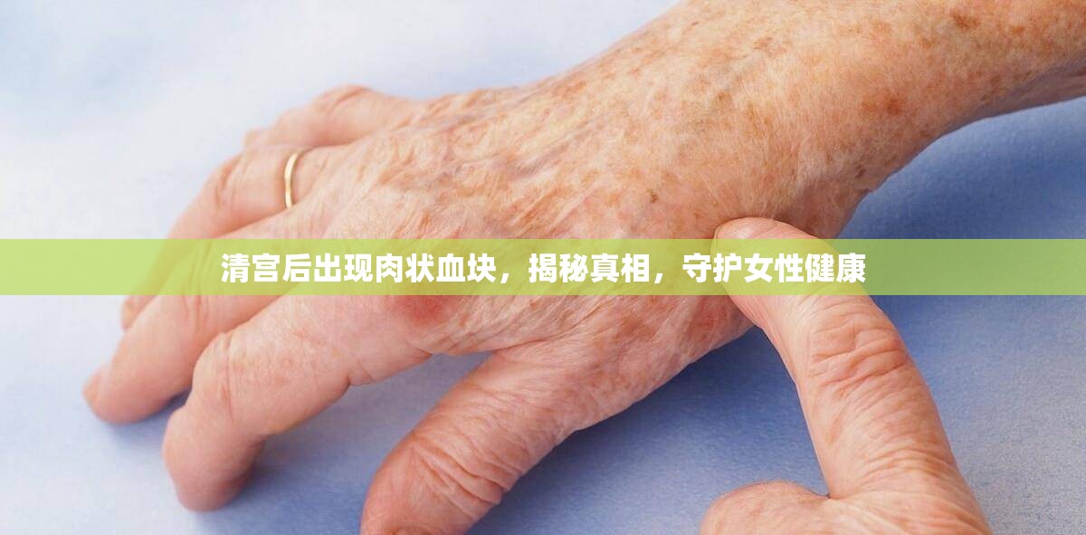 揭秘清宮術(shù)后肉狀血塊真相，守護(hù)女性健康