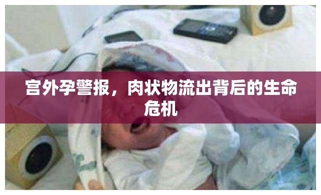 警惕宮外孕，肉狀物流出的生命警示