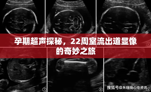 孕期超聲探秘，22周室流出道顯像的奇妙之旅
