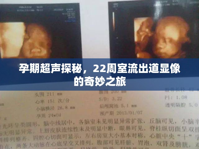 孕期超聲探秘，22周室流出道顯像的奇妙之旅