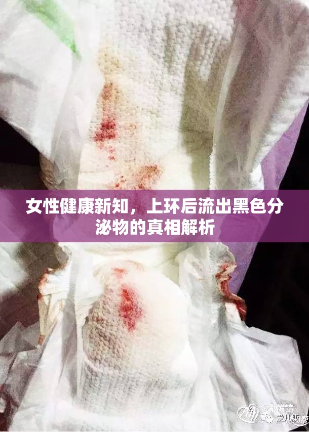揭秘上環(huán)后黑色分泌物，女性健康新知解析