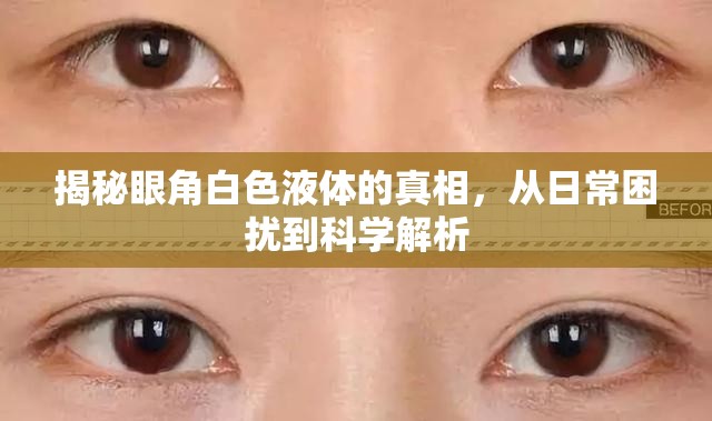眼角白色液體，日常之謎的科學(xué)解讀