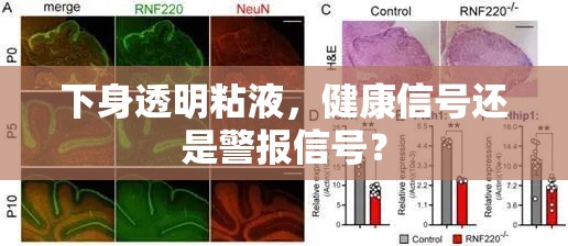 下身透明粘液，健康標(biāo)志還是潛在風(fēng)險(xiǎn)？