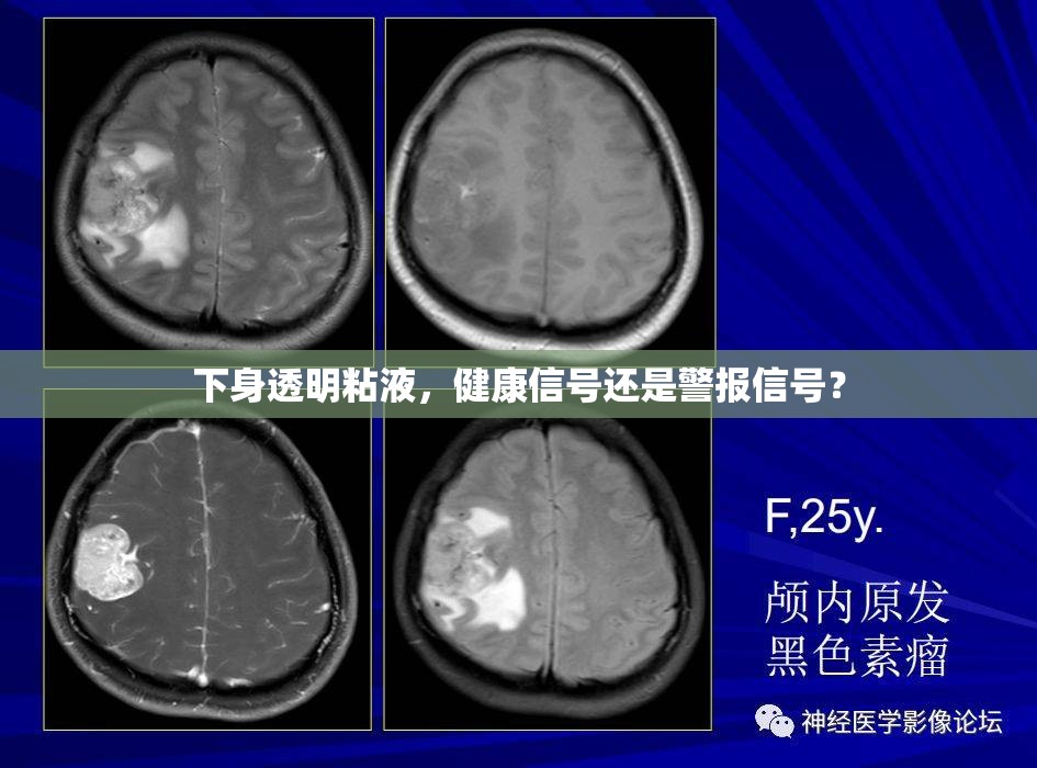 下身透明粘液，健康標(biāo)志還是潛在風(fēng)險(xiǎn)？