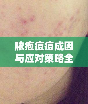 膿皰痘痘的根源與治療，全面解析與應(yīng)對指南