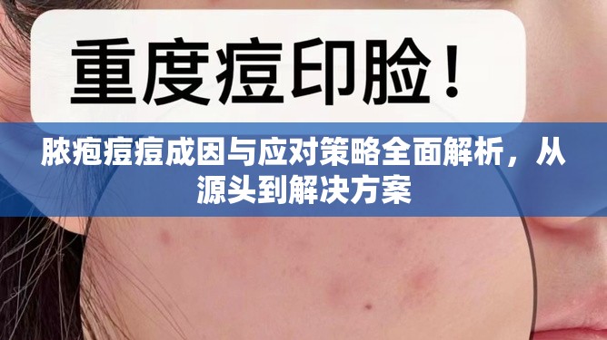 膿皰痘痘的根源與治療，全面解析與應(yīng)對指南
