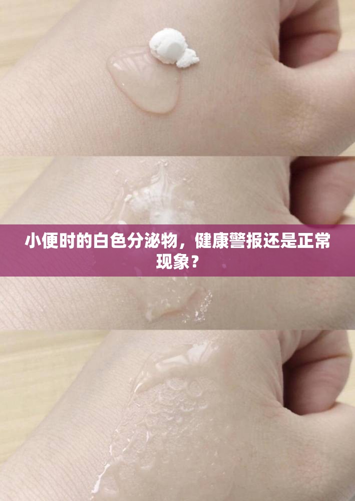 小便時(shí)的白色分泌物，健康警報(bào)還是正?，F(xiàn)象？