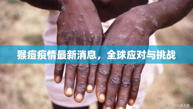 全球猴痘疫情，最新動態(tài)、應對措施與面臨的挑戰(zhàn)