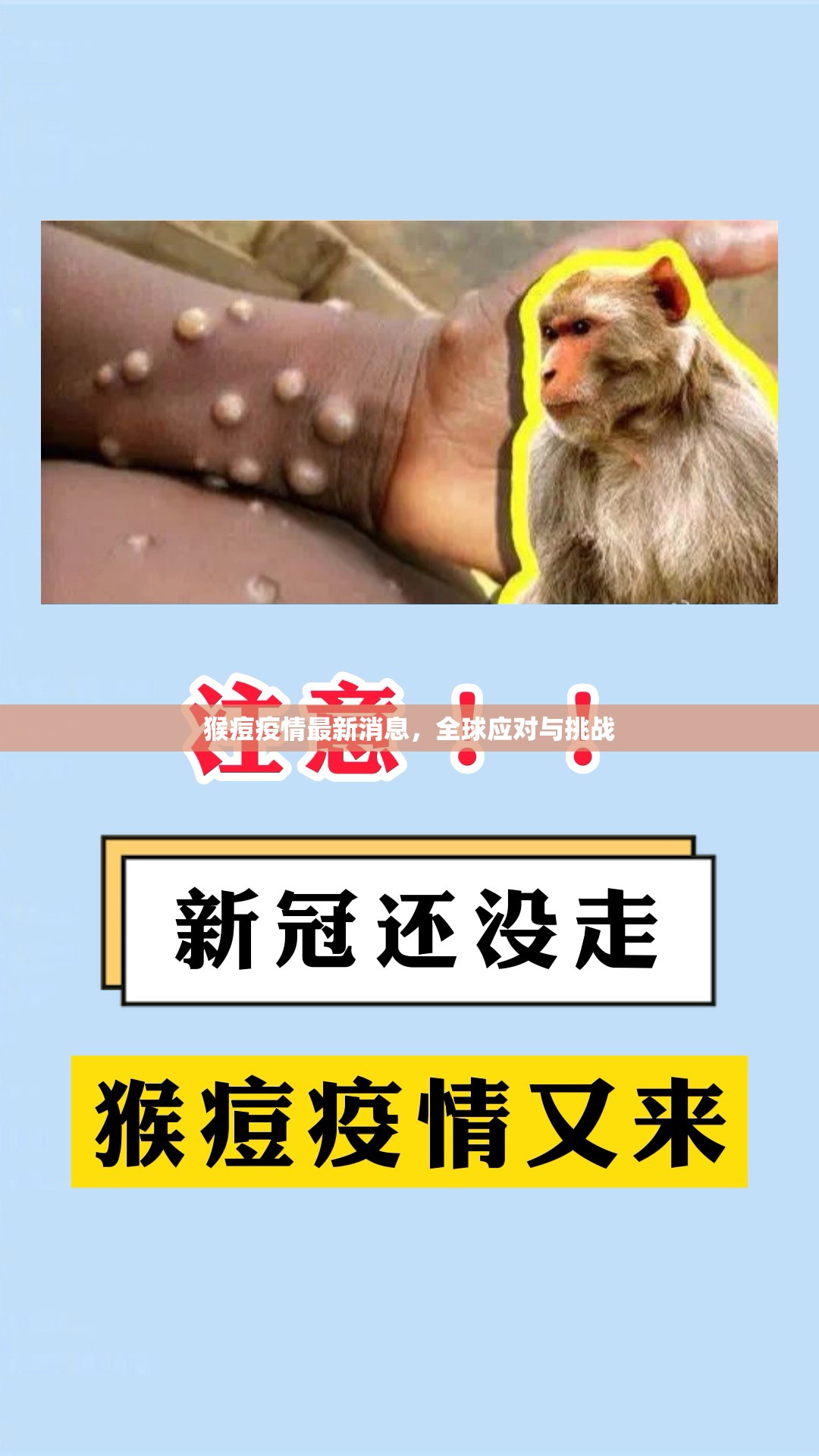 全球猴痘疫情，最新動態(tài)、應對措施與面臨的挑戰(zhàn)