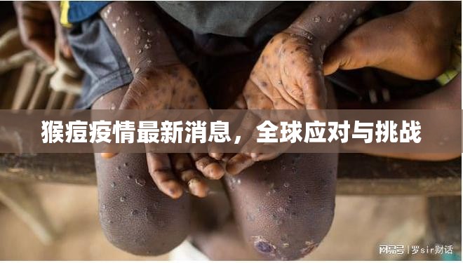 全球猴痘疫情，最新動態(tài)、應對措施與面臨的挑戰(zhàn)