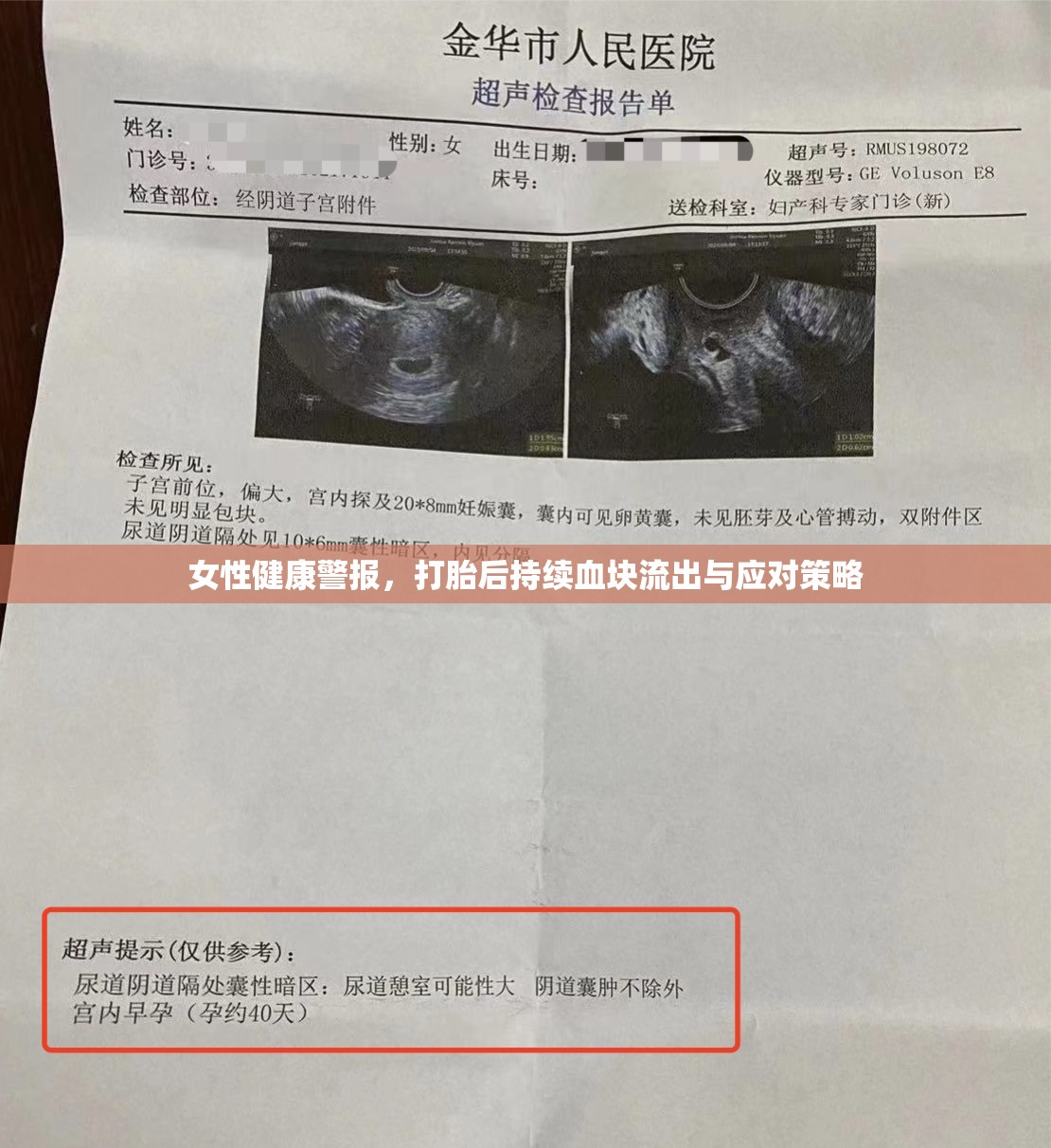 應(yīng)對打胎后持續(xù)血塊流出，女性健康警報與策略