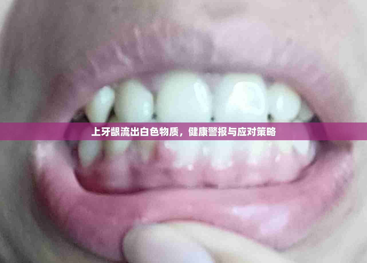 上牙齦白色分泌物，識(shí)別健康警告與制定應(yīng)對(duì)措施