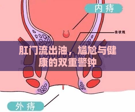 肛門異常排油，健康警示與應對策略