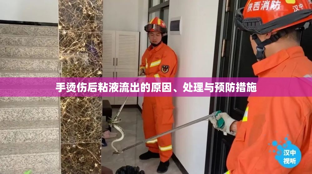 手部燙傷后粘液流出，原因、處理與預防