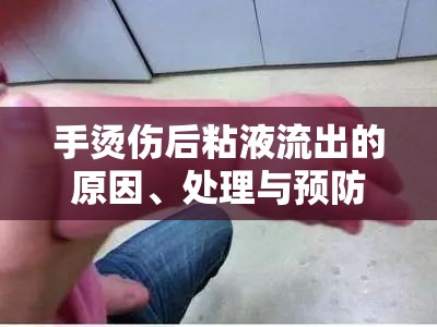 手部燙傷后粘液流出，原因、處理與預防