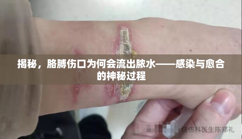 胳膊傷口膿液之謎，感染與愈合的科學(xué)解析