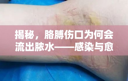 胳膊傷口膿液之謎，感染與愈合的科學(xué)解析
