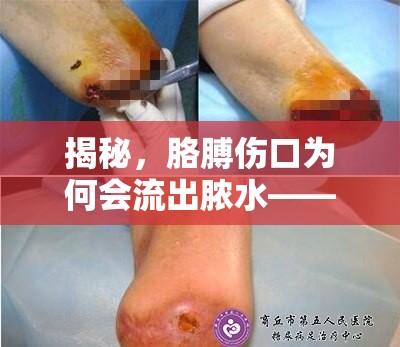 胳膊傷口膿液之謎，感染與愈合的科學(xué)解析