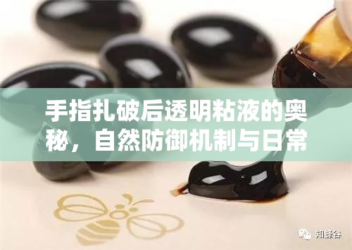 揭秘手指扎破后透明粘液，自然防御機(jī)制與日常護(hù)理
