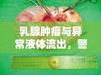 乳腺腫瘤與異常液體流出，識別健康警示信號