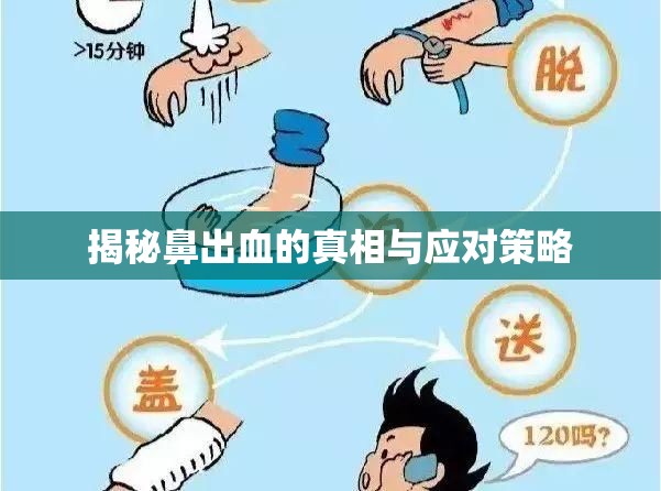鼻出血，原因、預(yù)防與急救指南