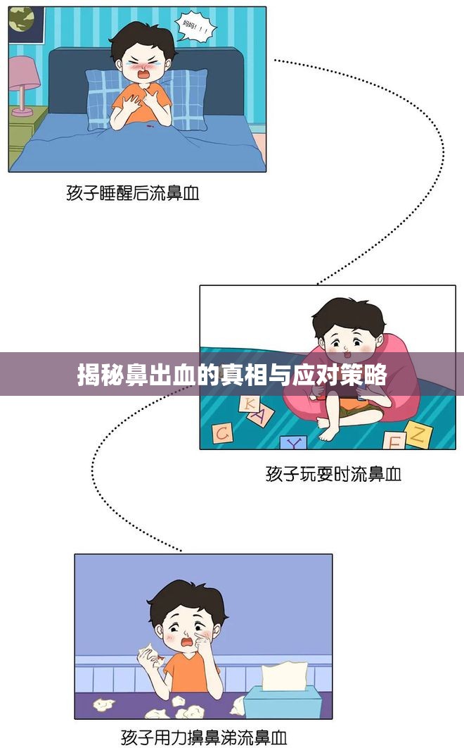 鼻出血，原因、預(yù)防與急救指南