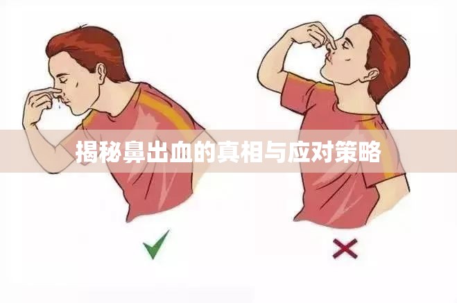 鼻出血，原因、預(yù)防與急救指南