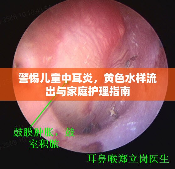兒童中耳炎警示，識別黃色水樣分泌物與家庭護(hù)理要點(diǎn)