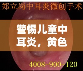兒童中耳炎警示，識別黃色水樣分泌物與家庭護(hù)理要點(diǎn)