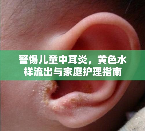 兒童中耳炎警示，識別黃色水樣分泌物與家庭護(hù)理要點(diǎn)