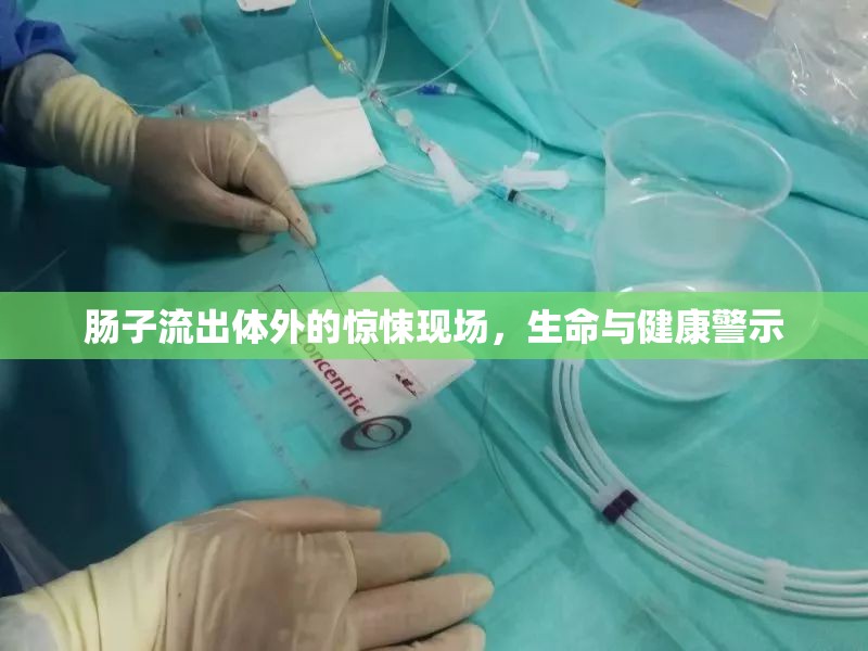 腸子流出體外的驚悚現(xiàn)場，生命與健康警示