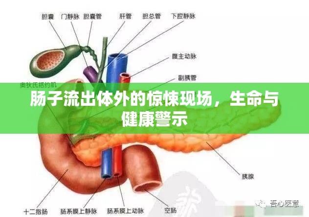 腸子流出體外的驚悚現(xiàn)場，生命與健康警示