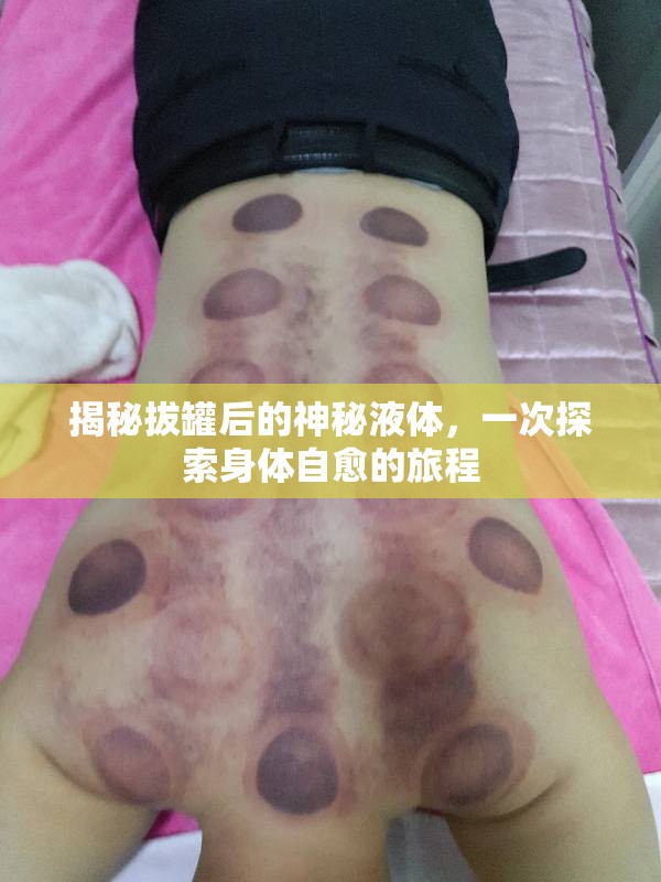 拔罐療法，揭秘神秘液體背后的自愈之謎