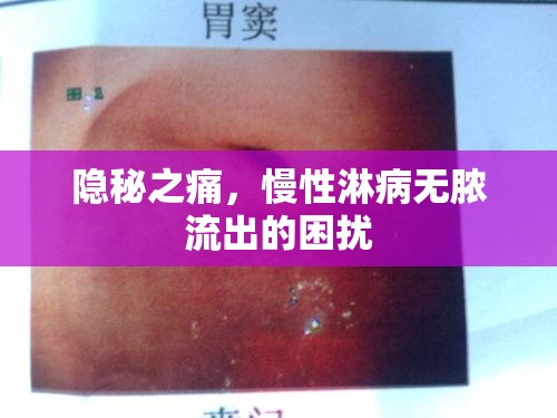 揭秘慢性淋病，無(wú)膿流出的隱秘之痛