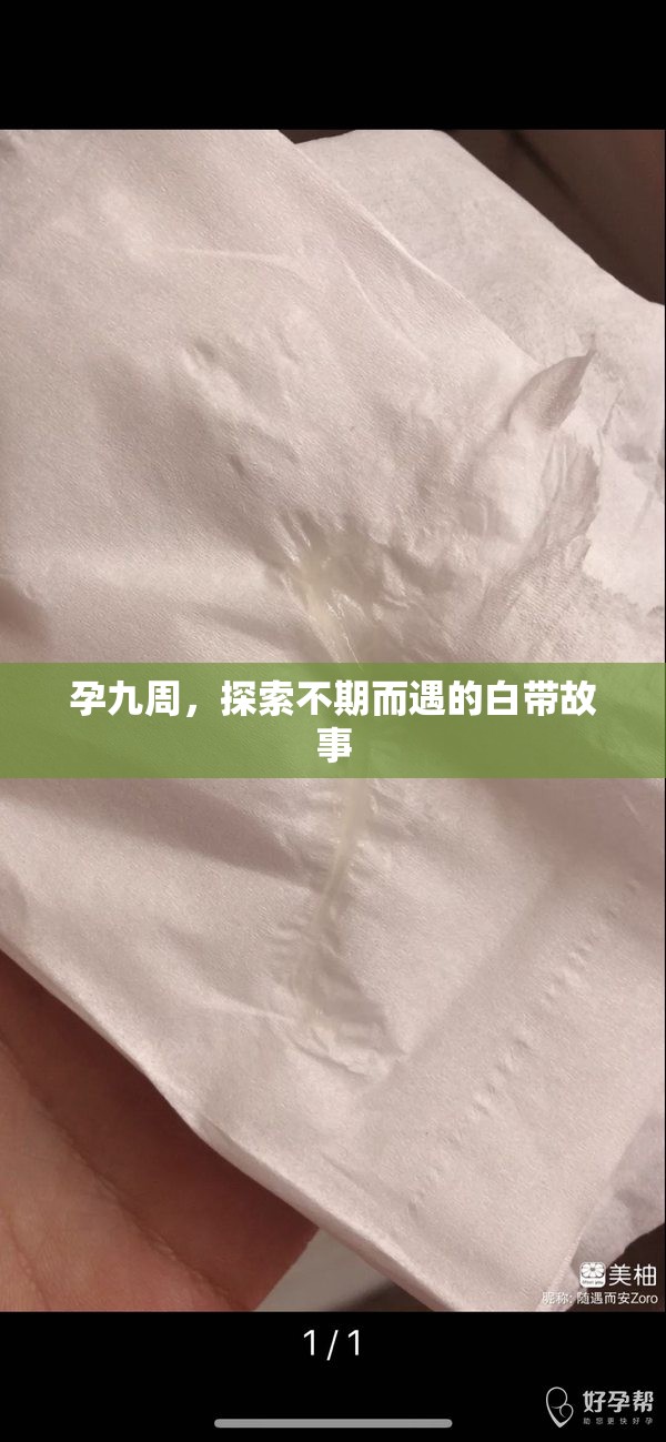 孕九周，探索不期而遇的白帶故事