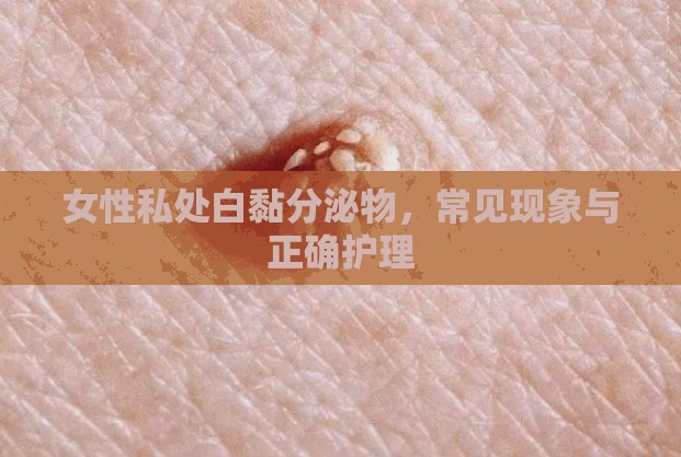 女性私處白黏分泌物，常見現(xiàn)象與正確護(hù)理