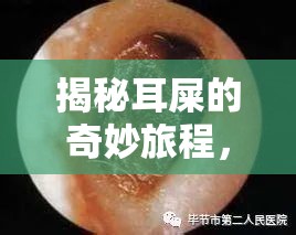 揭秘耳屎的奇妙旅程，為何它會自己流出來