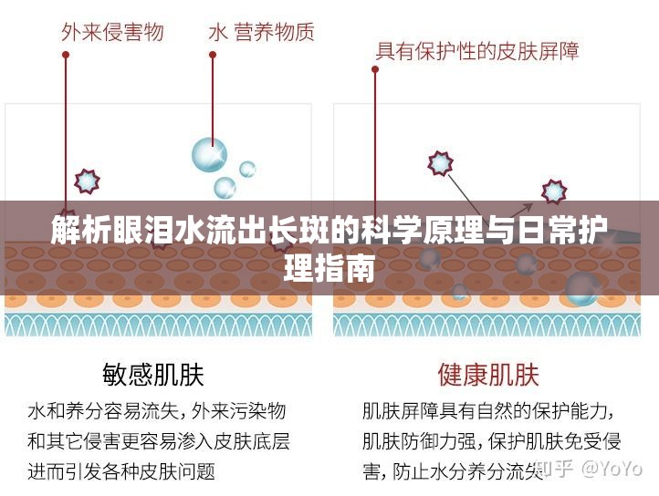 解析眼淚水流出長(zhǎng)斑的科學(xué)原理與日常護(hù)理指南
